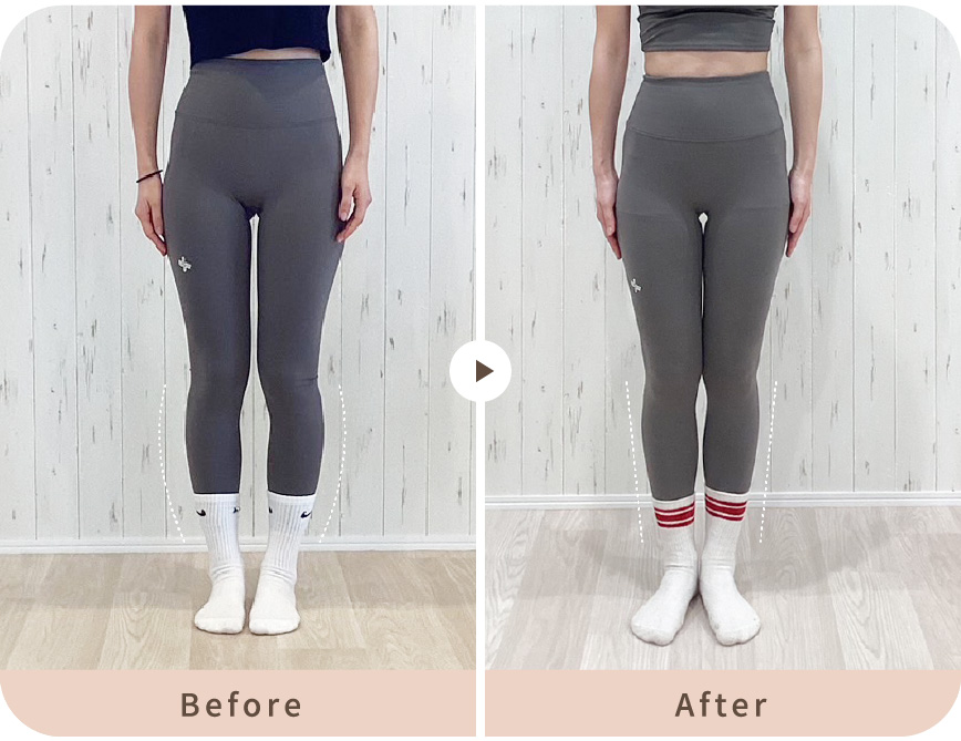 会社員女性 / 入会2ヶ月後